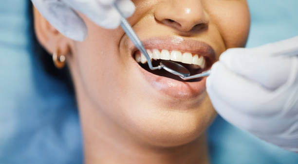 Best Emergency Wisdom Teeth Removal in Riva, MD