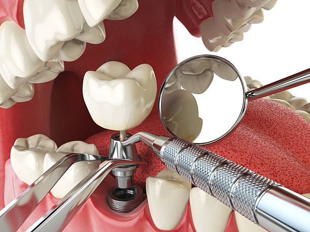 Best Emergency Treatment for Toothache in Riva, MD